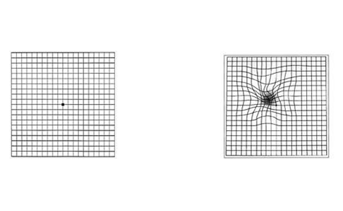 Amsler Grid Amsler Grid to test AMD